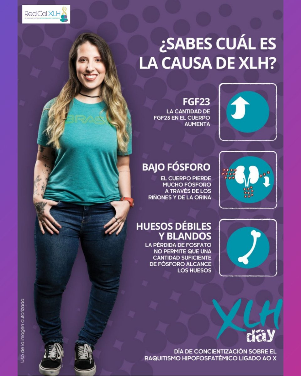 acopelcomunica's tweet photo. Con Hipofosfatemia Ligada al X (XLH), el cuerpo produce un exceso de una proteína llamada factor de crecimiento fibroblástico 23 (FGF23).
El diagnóstico precoz transforma vidas.
#RedColXLH #xlhstrong #xlhday #xlhawarenessmonth https://t.co/KoJtE0p6DE