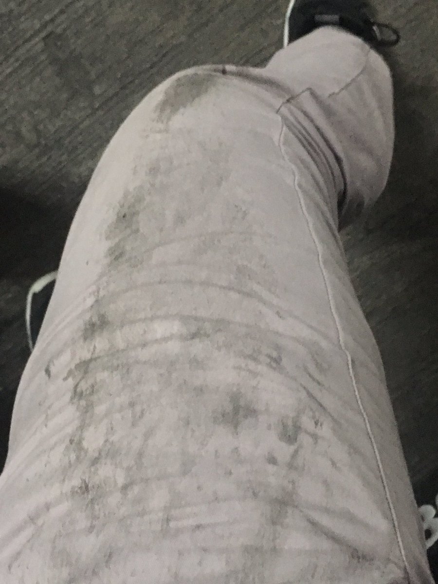 degaus_extreme's tweet image. Mohon perhatian nya untuk yg berwenang @MalioboroMall saya kurang tau bagaimana tp campuran air dengan oli Itu sangat licin , saya habis jatuh siang ini terpeleset naik motor di basement mall anda saat menunju parkiran motor ...