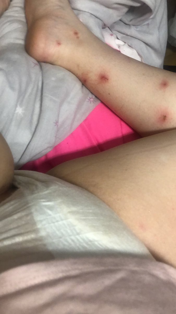 little squish (@littleriley20) / Posts / X