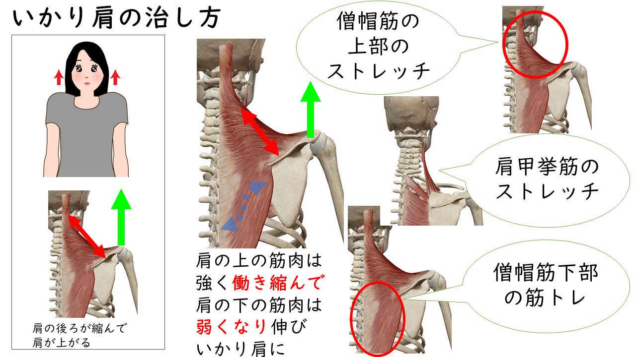 もむだけでなく 肩こり を原因から治す方法 Twitter