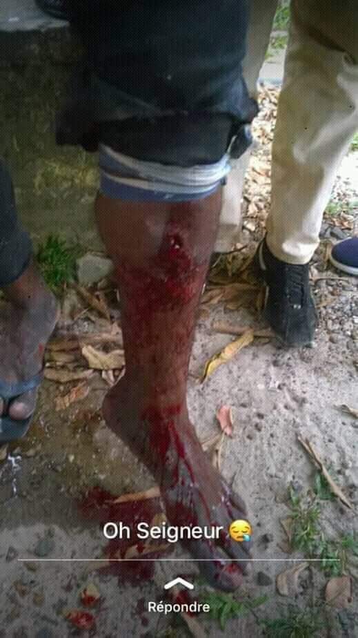 BrunoCacique's tweet photo. Voici ce que la #Police d'#AliBongo utilise pour disperser des étudiants qui réclamant des bourse. #Gabon
@ONU_fr @dw_francais @africapostnews @AFRICA24TV @amnestyfrance @bbcafrique @BFMTV @Deputee_Obono @bernardpivot1 @benoithamon @CNEWS @DelphLecoutre https://t.co/8TCkptl2l3