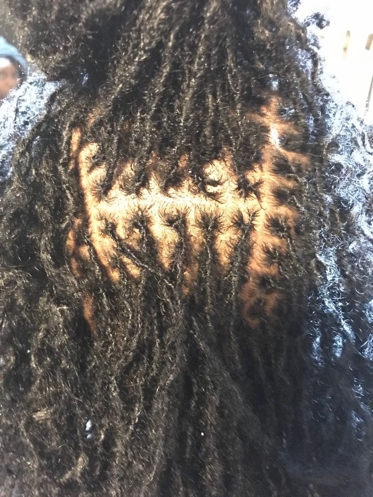 @thehouseofshayaa Loc maintenance time scale ( quick example)
#locretwist 2-6 weeks
#interlock 4-6 weeks
#combcoil 4-6 weeks
#twostrandtwist 4-6 weeks
#cornrow 4-6 weeks
@thehouseofshayaa