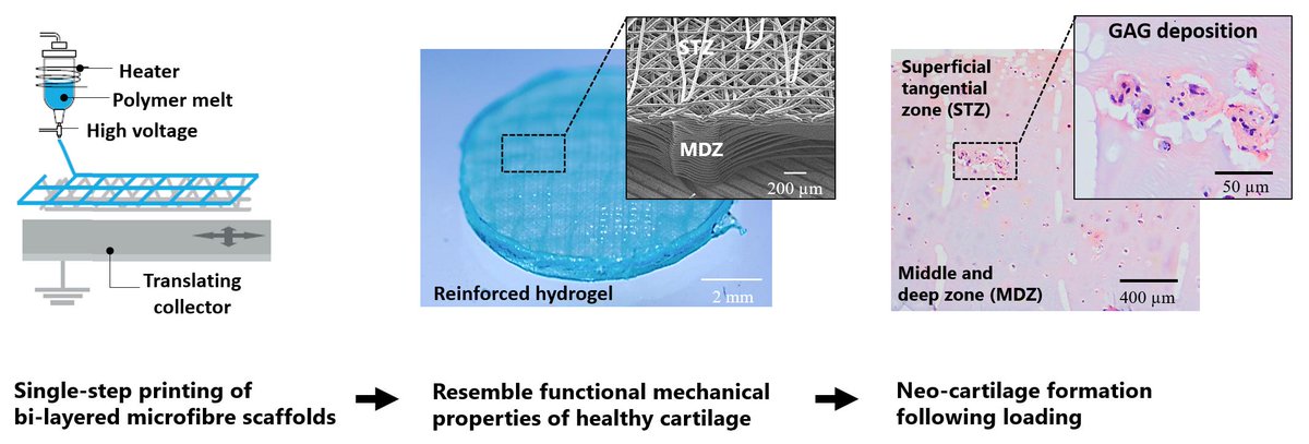 When designing implants for articular cartilage regeneration the superficial-tangential-zone is often overlooked. Check out our bi-layered fibre reinforced cell laden hydrogel implants if you want to know more doi.org/10.1016/j.actb… <a href="/ActaBio/">Acta Biomaterialia</a> <a href="/josmalda/">Jos Malda</a> <a href="/RMUtrecht/">RM Utrecht</a> <a href="/TUeindhoven/">Kumar Dhistraj</a>