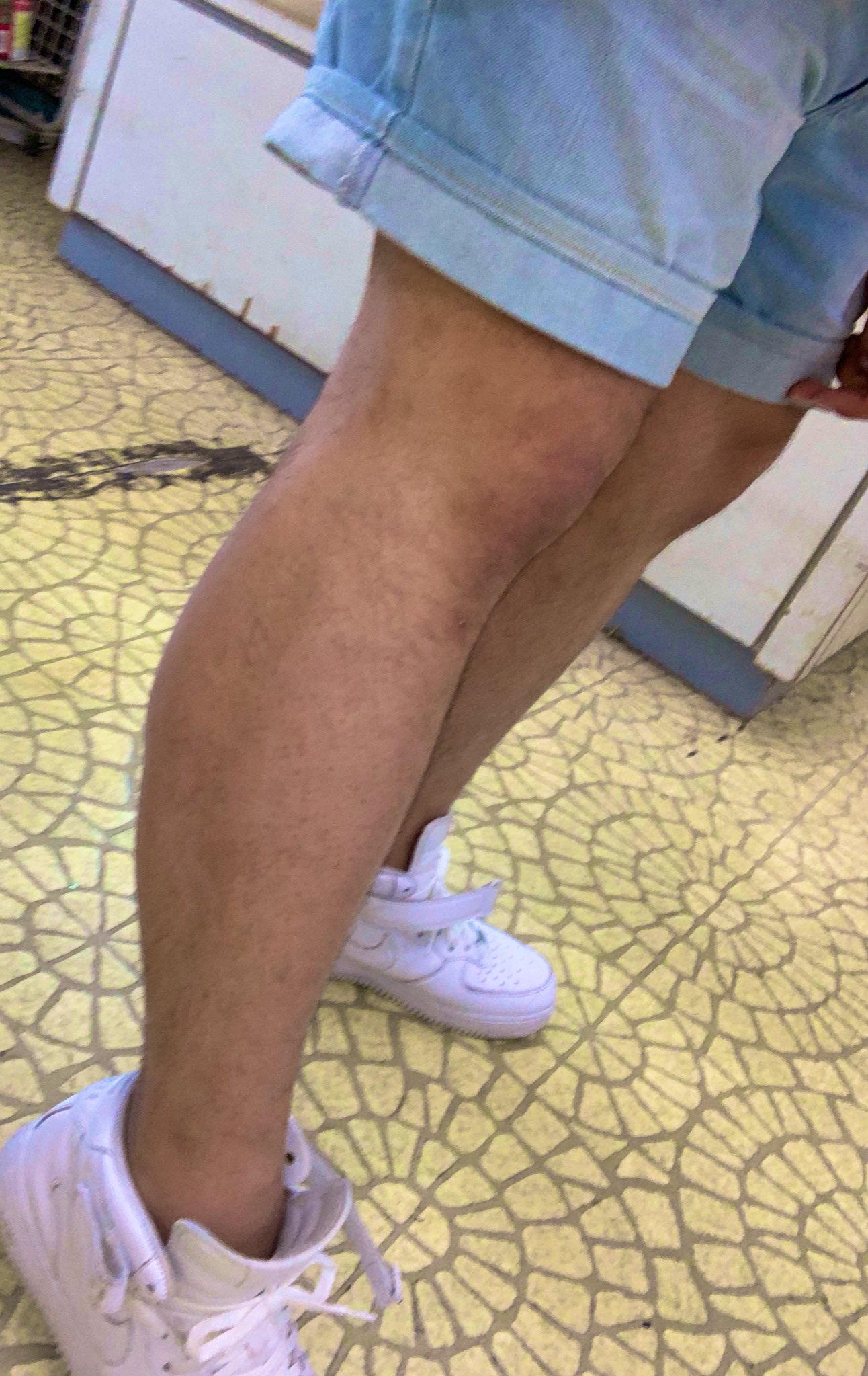 Uzivatel Kodo Na Twitteru 無駄に足太い 足細くならんかなー 普通の 履いても全部スキニーみたいになるなる 足首とか細く見えるけどふくらはぎでかいだけw