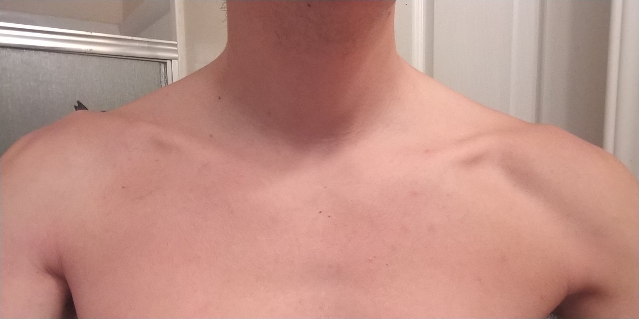 Benjamin A. on Twitter "I'm happy to say my collar bones are disappearing..... Something that
