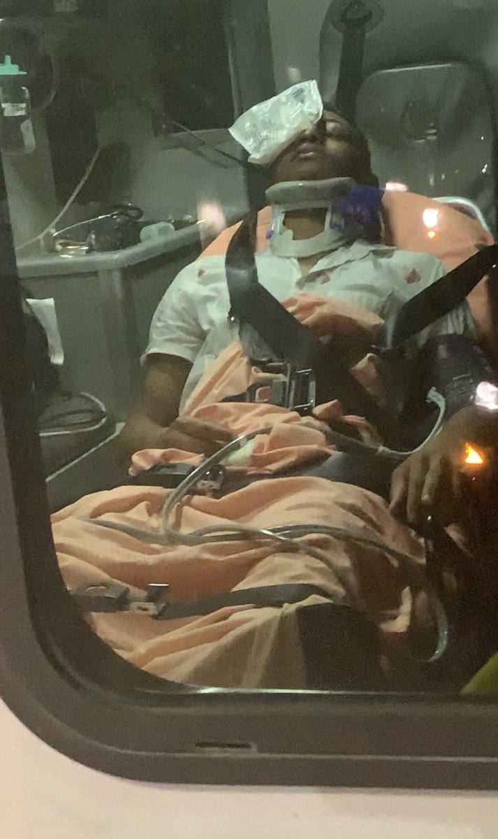 driplikejuicy's tweet photo. Last night at “Big Sky Restaurant &amp; Bar” in Buckhead Atlanta, Georgia my friend was assaulted by the police. Officer C. Milton proclaims these injuries are due to a “fall.” Officer J. Gikanga threatened him w/ jail time for attempting to press charges! PLEASE READ AND WATCH!!! https://t.co/cl4t2nusUZ