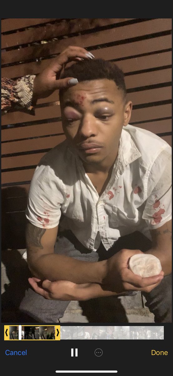 driplikejuicy's tweet photo. Last night at “Big Sky Restaurant &amp; Bar” in Buckhead Atlanta, Georgia my friend was assaulted by the police. Officer C. Milton proclaims these injuries are due to a “fall.” Officer J. Gikanga threatened him w/ jail time for attempting to press charges! PLEASE READ AND WATCH!!! https://t.co/cl4t2nusUZ
