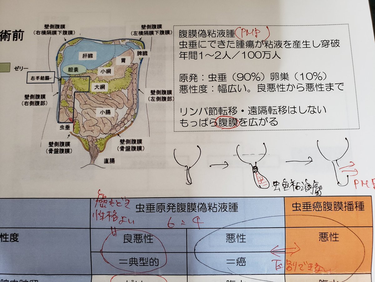 腹膜 偽 粘液 腫 ブログ