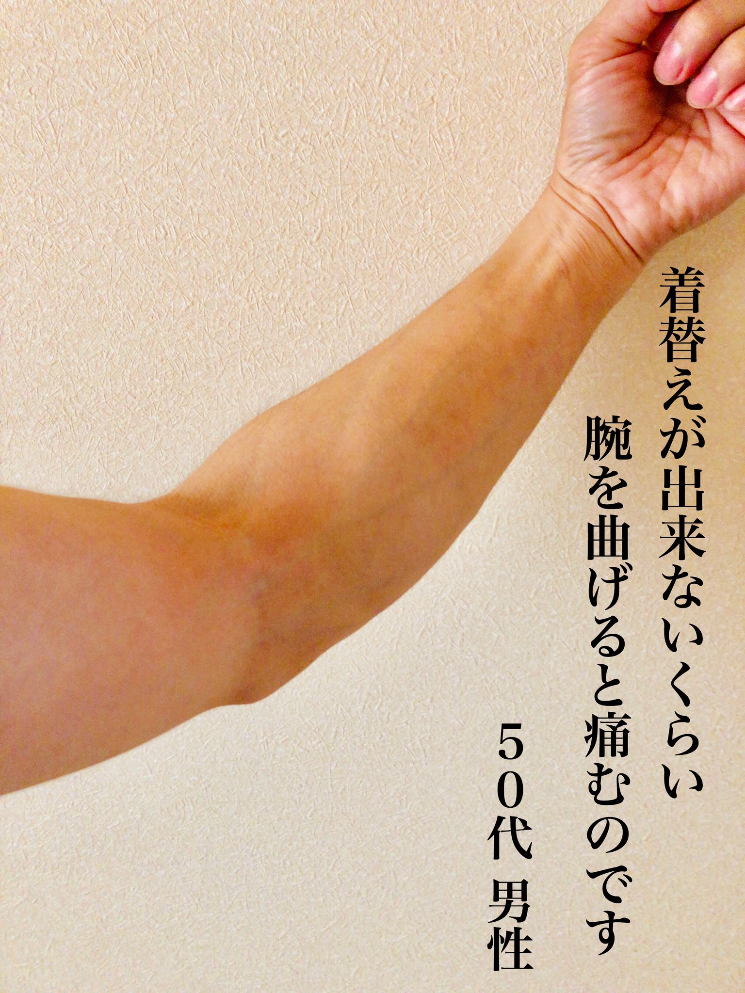 小樽カイロプラクティックみっきー 着替えが出来ないくらい 腕を曲げると痛むのです と訴える50代男性 病院では異常無し 背中は板のように硬い状態 土台の骨盤を整えて痛みを確認すると え 痛みが減ってる やはり 背中や骨盤周りの硬い