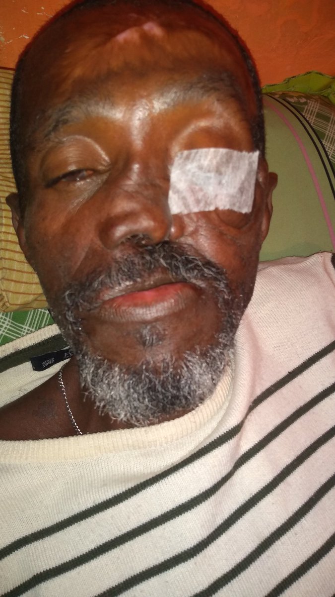 onofreerica1's tweet photo. Boa noite a todos, esse da foto é meu pai estamos passando por uma luta contra o câncer, retirada de um câncer de quase 1k, agora estamos na radioterapia com ele durante 1 mês e 15 dias, minha mãe não trabalha mas por conta dos cuidados que ela tem que ter com ele no comentário https://t.co/tMT1vW0qJm
