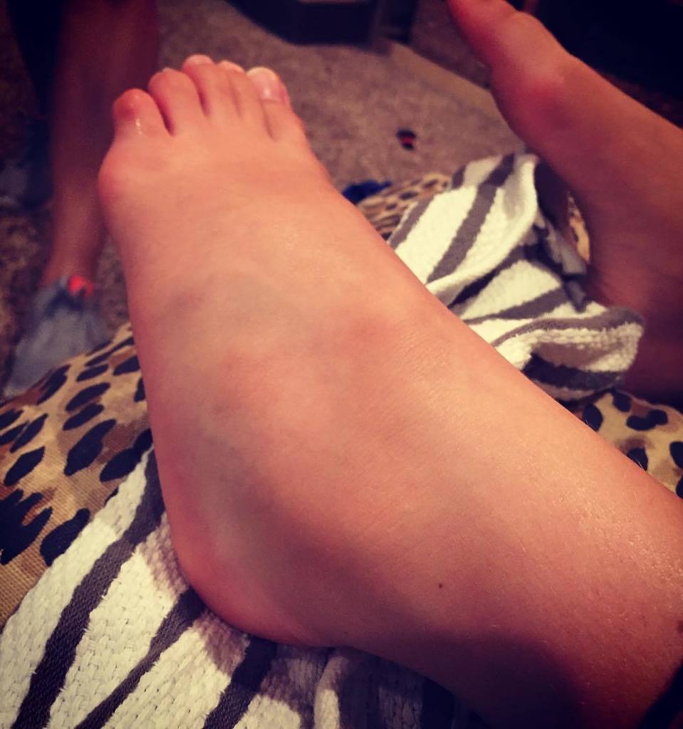 asnow's tweet photo. Anybody's kids sprained their ankle? It's swelled up pretty good in the last few hours. She says she can't put wei… https://t.co/9OzDfcSNh1 https://t.co/ZTaDX62F2y
