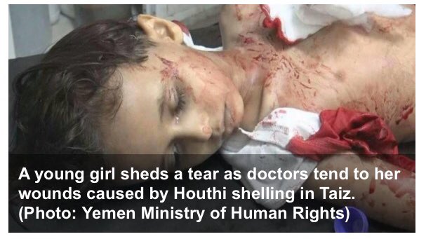 randomspotligh1's tweet photo. #SOS_YemenGenocide #YemenBleeds PLS  #StandWithYemen 's #Children .We want  #Peace4Yemen #HouthisAreStarvingYemenis  
#HelpYemenChildren https://t.co/G4X14JYY2h