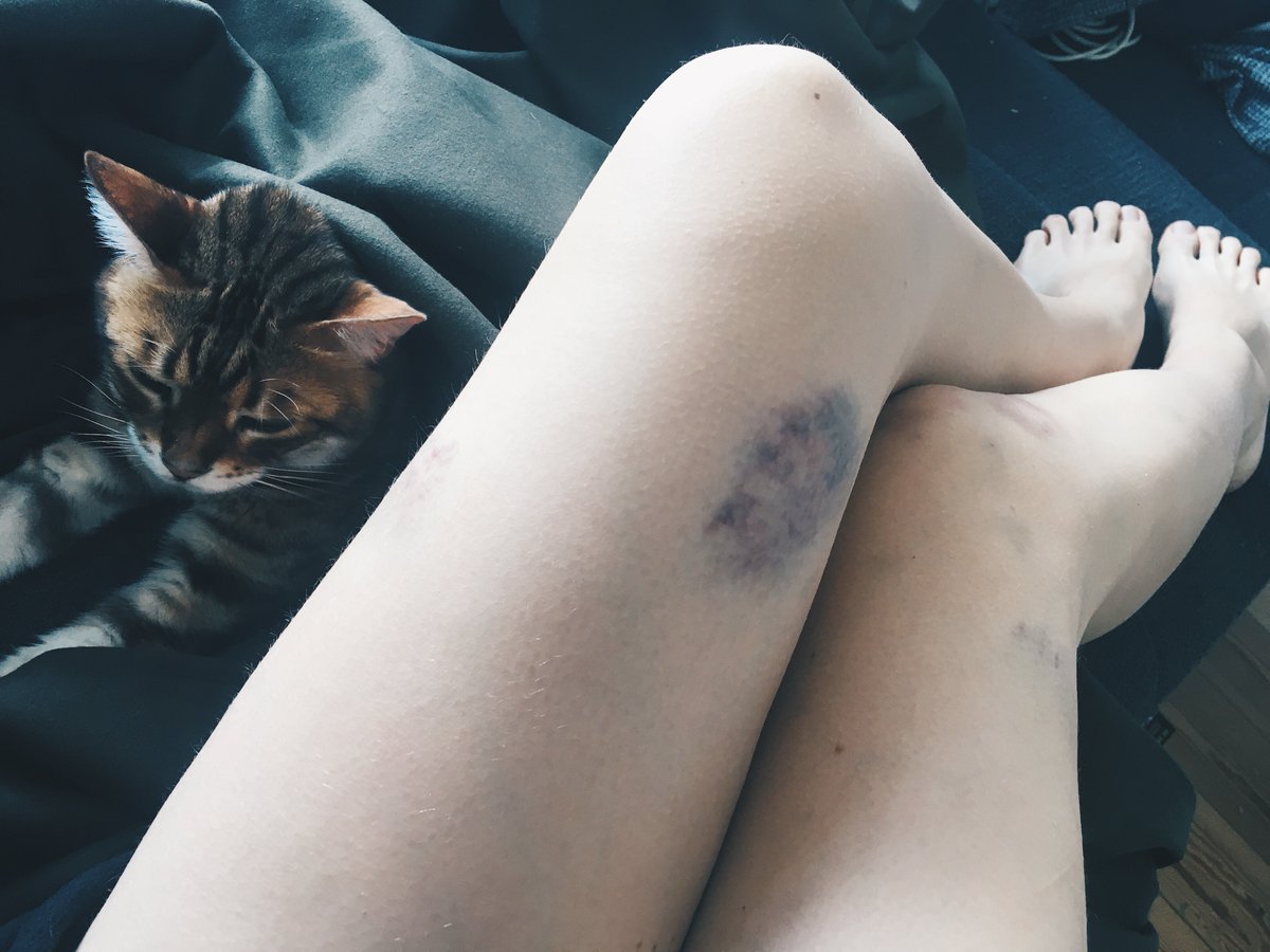 OddNina's tweet photo. Tja nun.. #hingefallen https://t.co/b3WEgtPZ1r