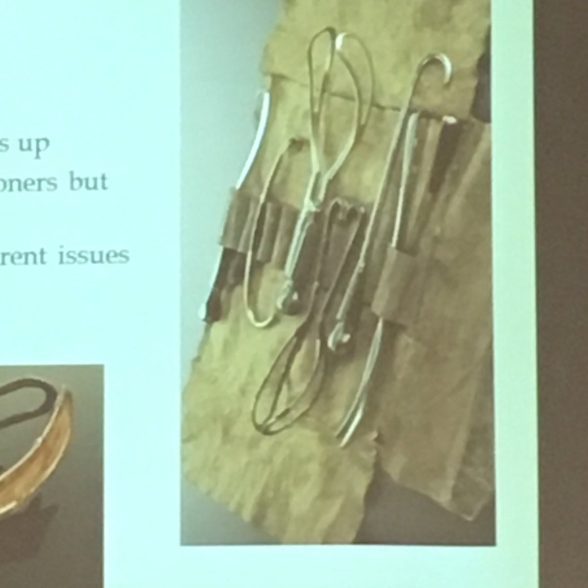 anatomy_jackson's tweet photo. Hanson: Obstetrical tool design was functional, practical, but centered on (male) obstetrical convenience. @HumanAandPSoc #haps2017 https://t.co/3bDNetHn6g