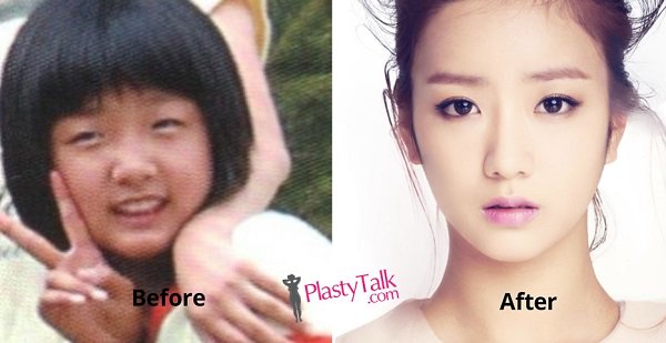 Apink Plasticsurgery Nevermind192 Twitter