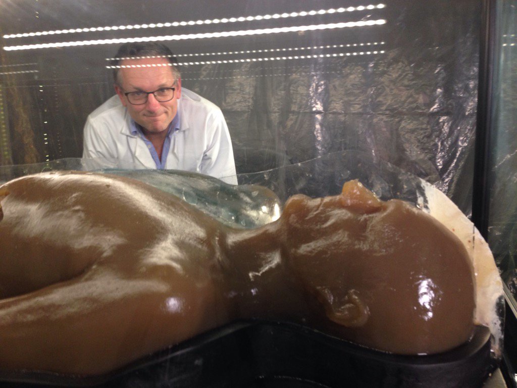 Me and my agar body double prior to giving him a nasty series of infections..