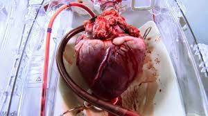 _alexusliann's tweet photo. For a transplant the heart can only be preserved for 4-6 hours while a kidney could last up to 36 hours. #rhsbms https://t.co/qOTAyFMk3C