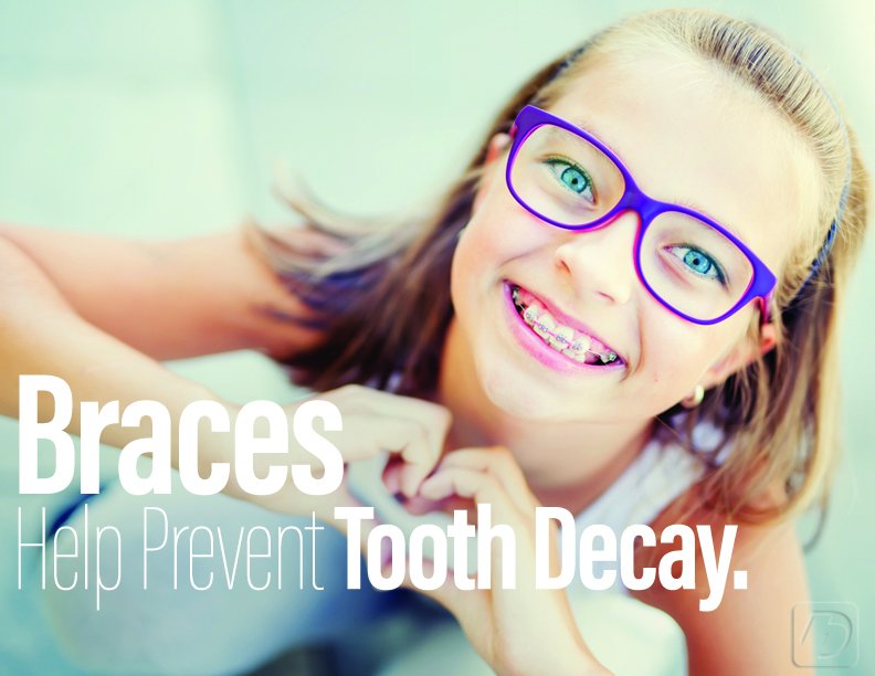Corsa_Ortho's tweet photo. Straight teeth are easier to keep clean, which means fewer cavities. https://t.co/3NxX013Vwq