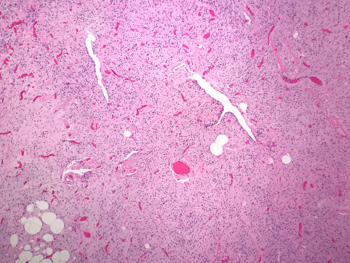 BSTPath tweet picture