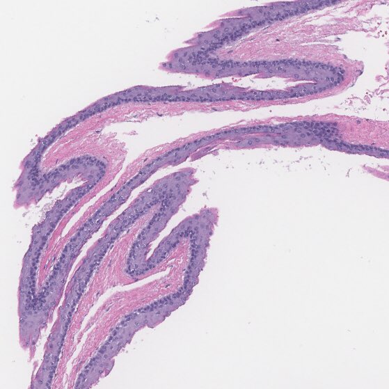 BSTPath tweet picture