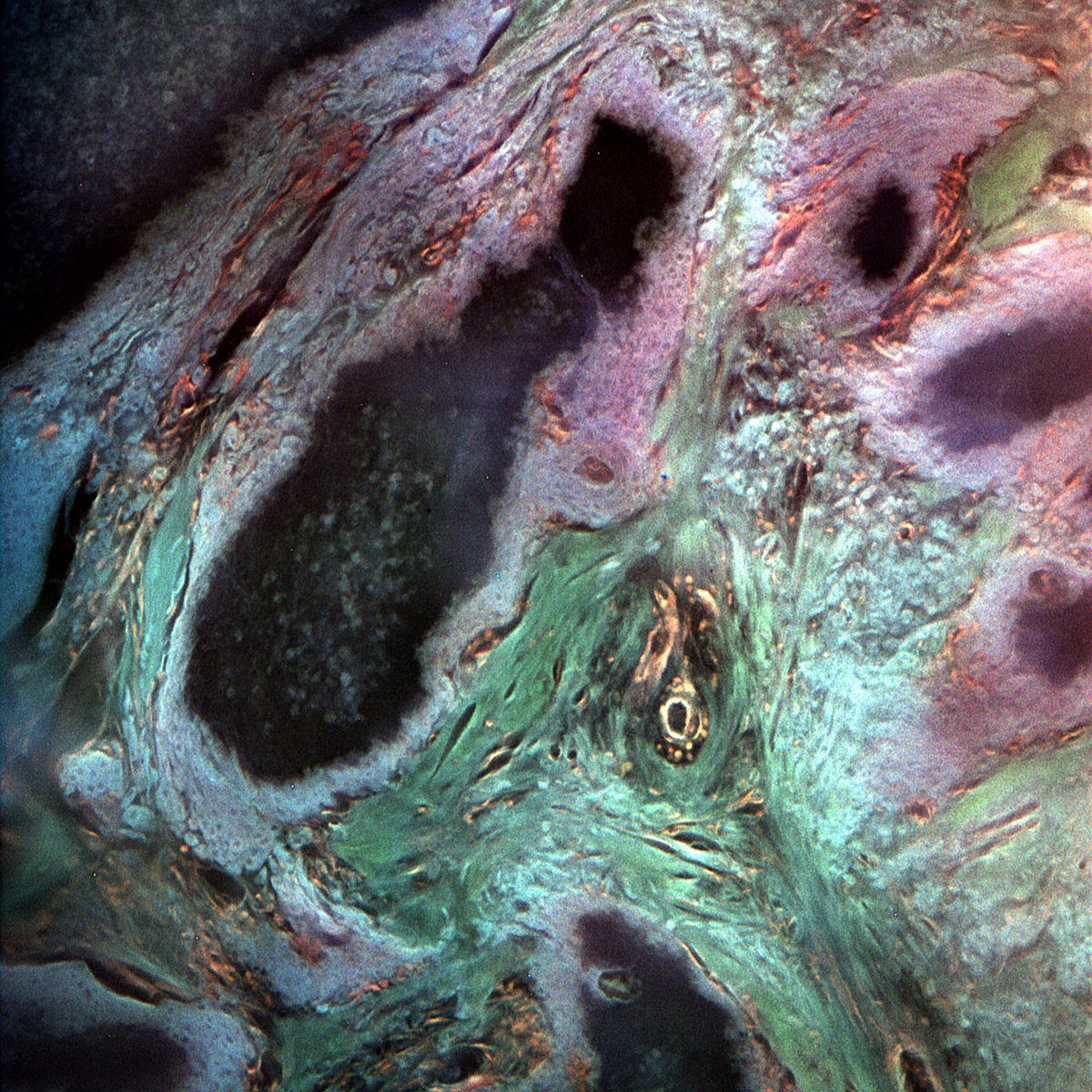 BSTPath tweet picture