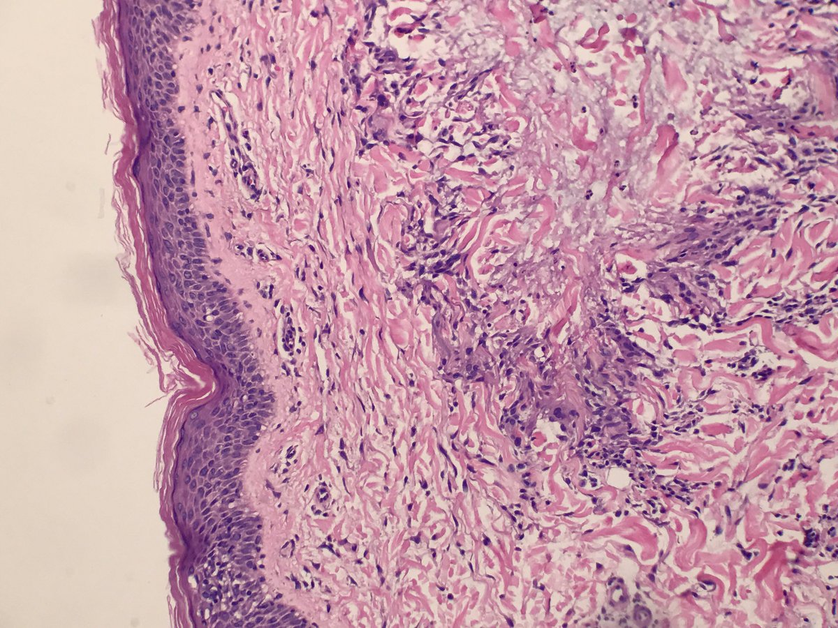 BSTPath tweet picture