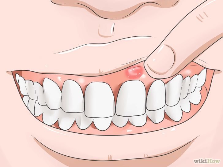 CEIO_Centros's tweet photo. La visita al #dentista, más allá de la salud bucodental: detección de diabetes y patología cardiovascular https://t.co/5g5YwLThAv https://t.co/w3hBv9tamt