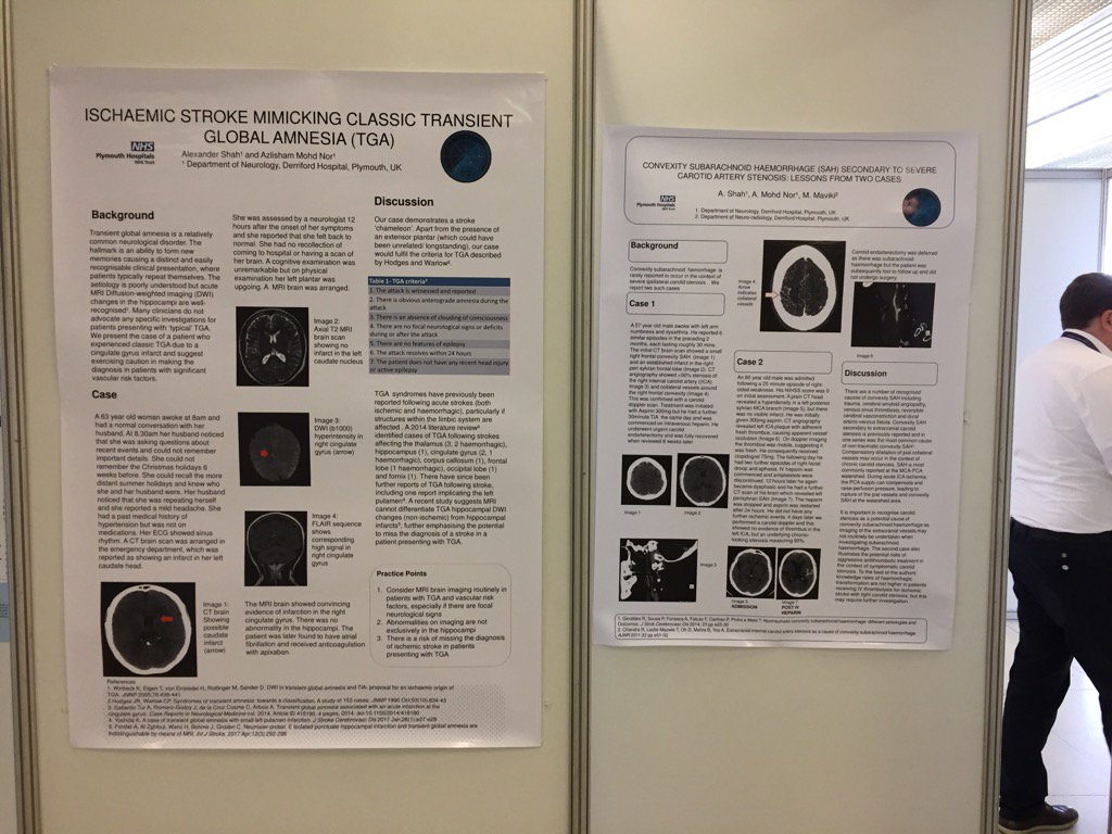 neurosonar's tweet photo. Check out one of our Southwest trainees posters at #ESOC2017 #esoc17 https://t.co/QnNN50g2Br