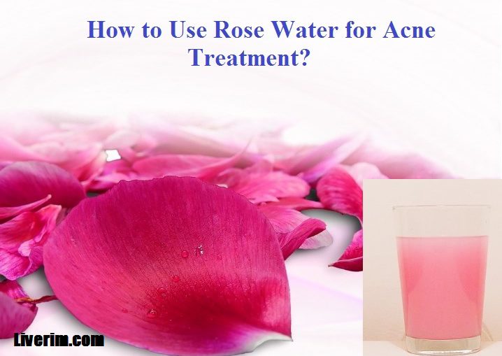 Liverimdotcom's tweet photo. 7 Easy Methods to Use #Rose Water for #Acne #Treatment
https://t.co/9xepgjslOg
#boils #HomeRemedies #rosewater #beauty #skincare #skin #cure https://t.co/PYDle0dhpa