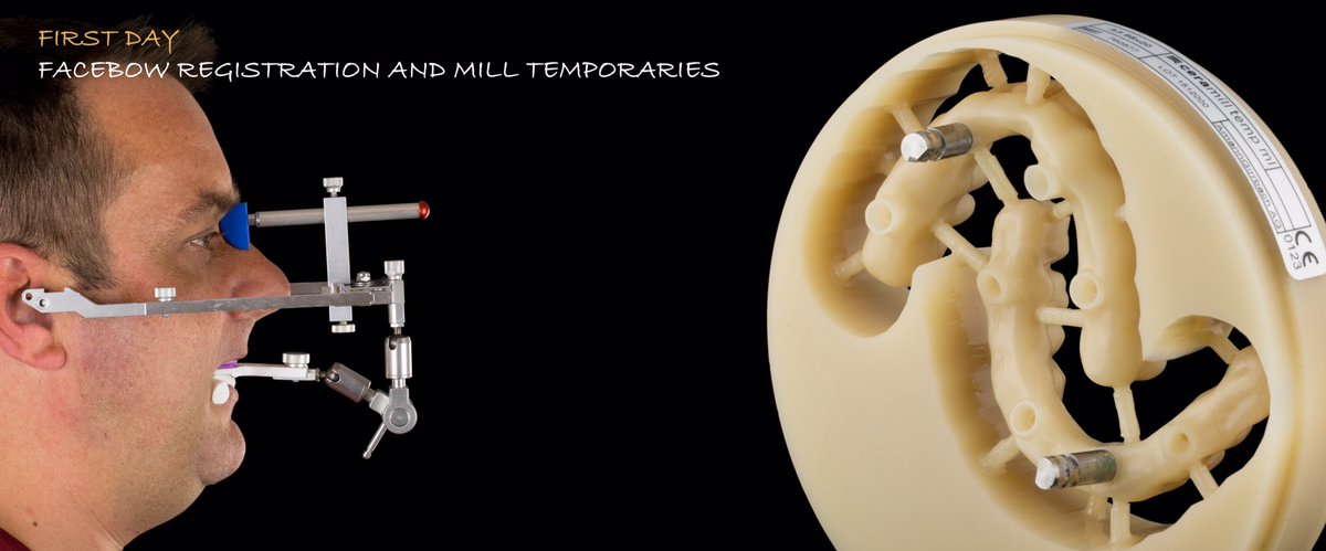 pavelmetelka's tweet image. First day of #all_on_four implant restoration.
@Amann_Girrbach #Facebow registration and Smile Designer result milled in Temporaries.