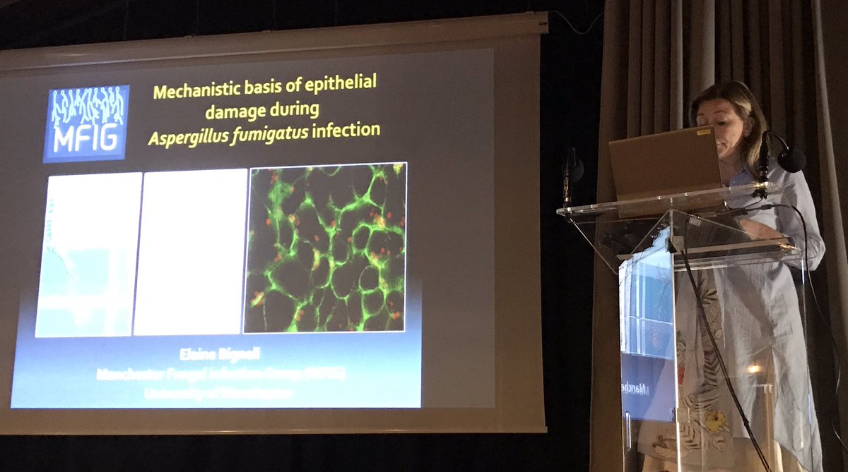 AFGTweets's tweet photo. Elaine Bignell @UofMMFIG penultimate science talk #hfp2017 on her elegant work on #Aspergillus fumigatus interaction in #alveolar space https://t.co/THnmfSJl4G