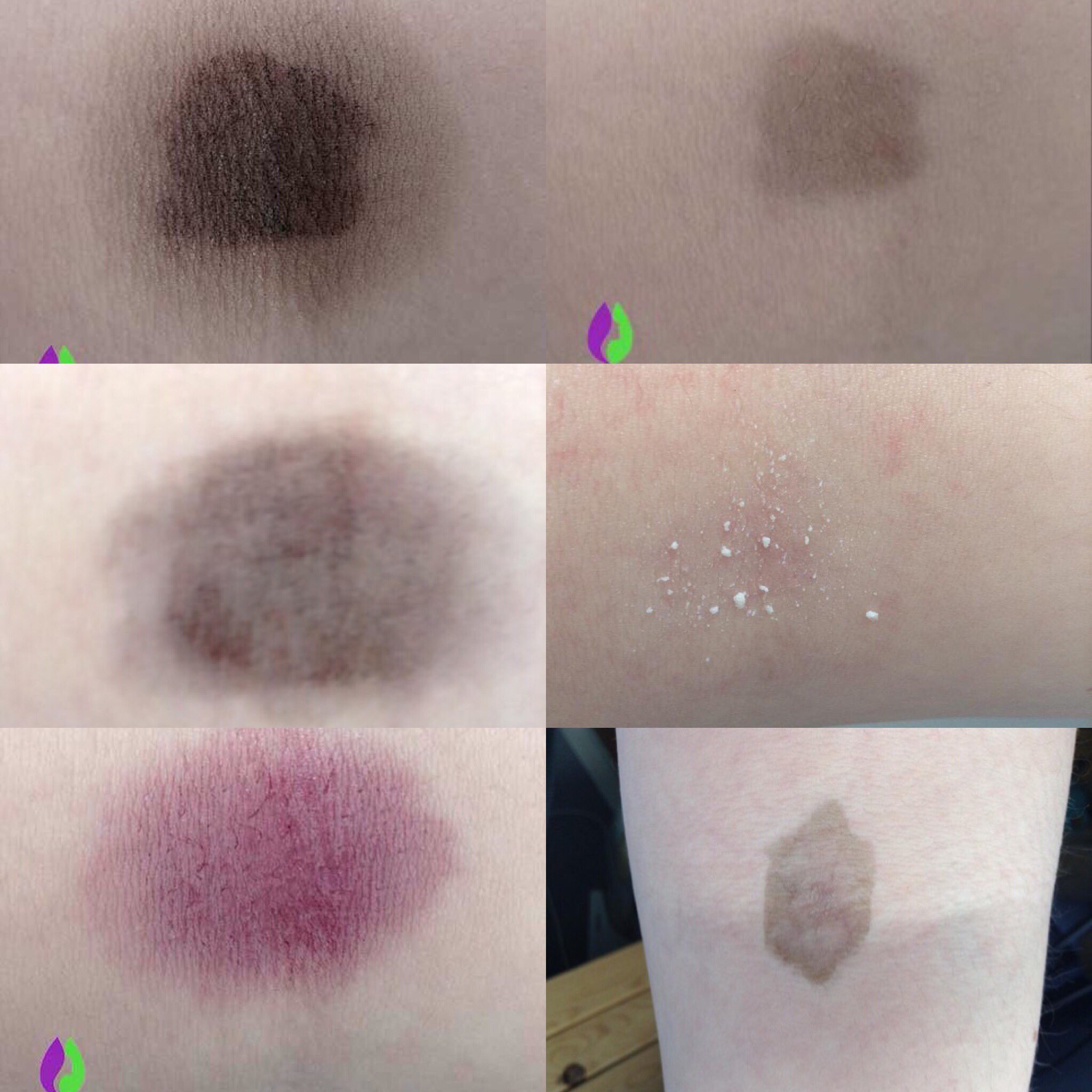 Charlottewelch Mixez On Twitter Refreshing Your Hair For Summer Don T Forget To Do A 48hr Hair Dye Skin Allergy Patch Test Https T Co Xojdl160so Empowerment Https T Co Wnrebyj1bl