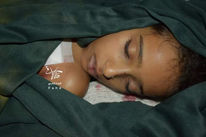 BasemAlabsi's tweet photo. #The_old_airport
À girl Safaa was shot by a sniper of Houthi&amp;Saleh militias stationed on Ghorab west of #Taiz #Yemen https://t.co/0t7keO5kES