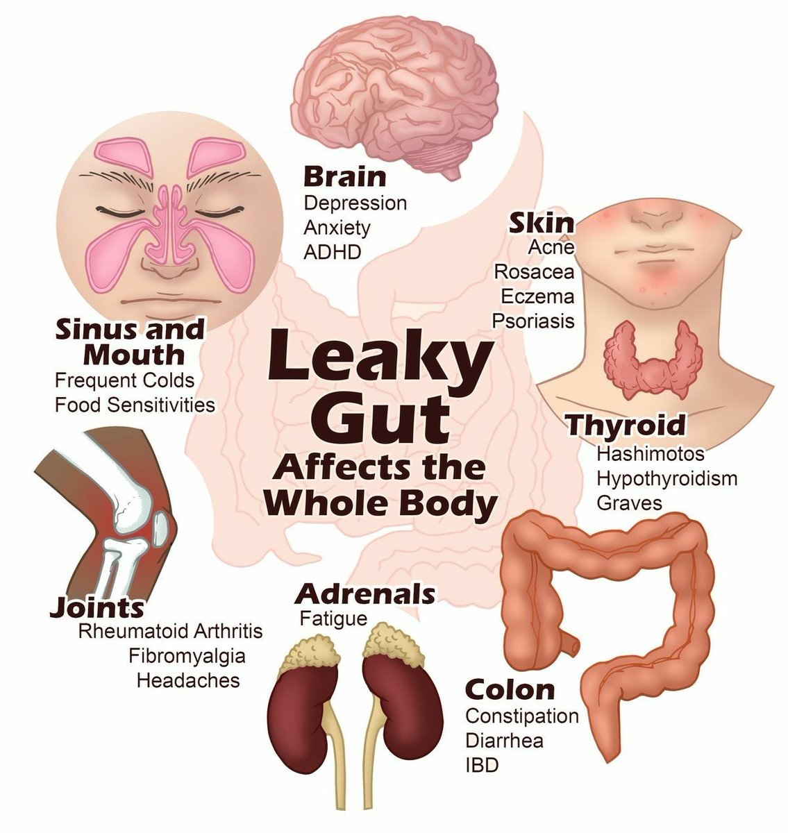 ajaisha995's tweet photo. So tell me, do you still think you don't need #Plexus??
#LeakyGut #GutHealth #TriplexCombo #GetYouSome #60DayMoneyBackGuarantee https://t.co/zN39SgtJ2h