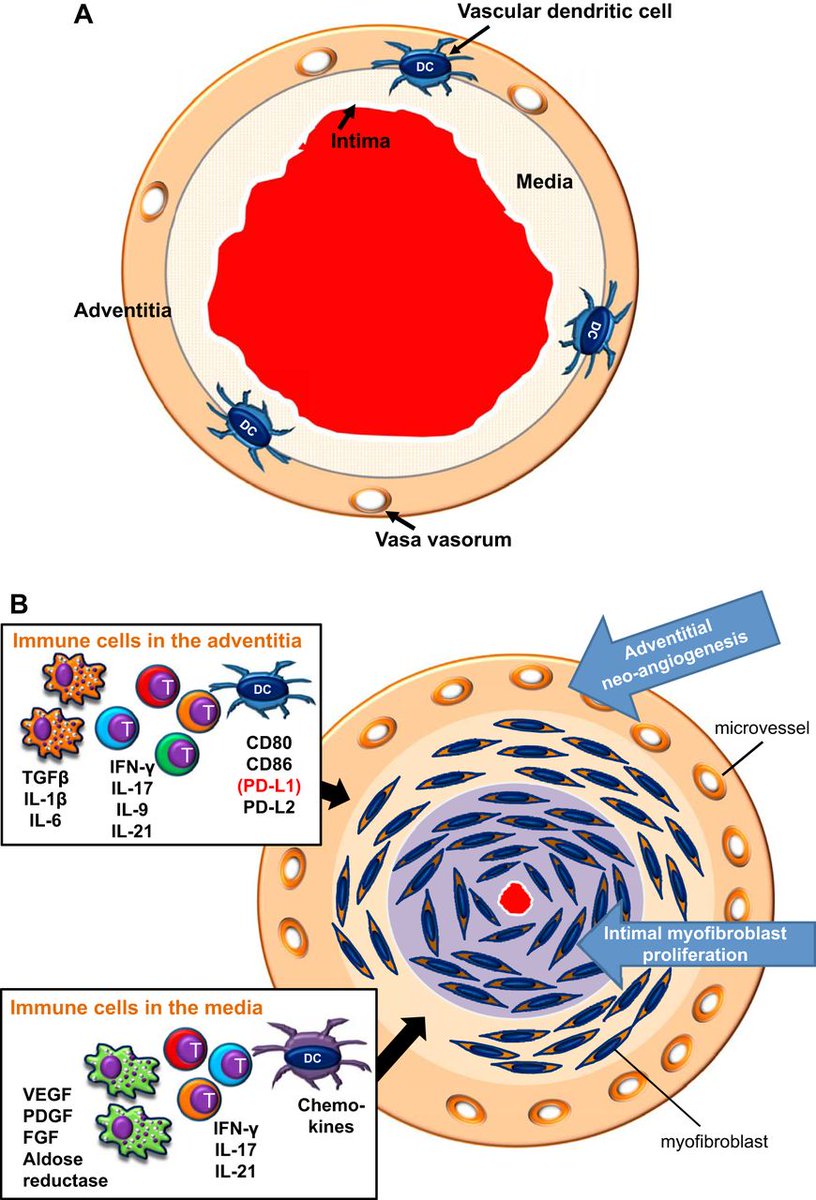 ajpheartcirc's tweet photo. #Immune #checkpoint dysfunction in large and medium vessel #vasculitis https://t.co/3sN0uisnVD #imagesoftheweek #lectureworthy https://t.co/R8jcWVExLR