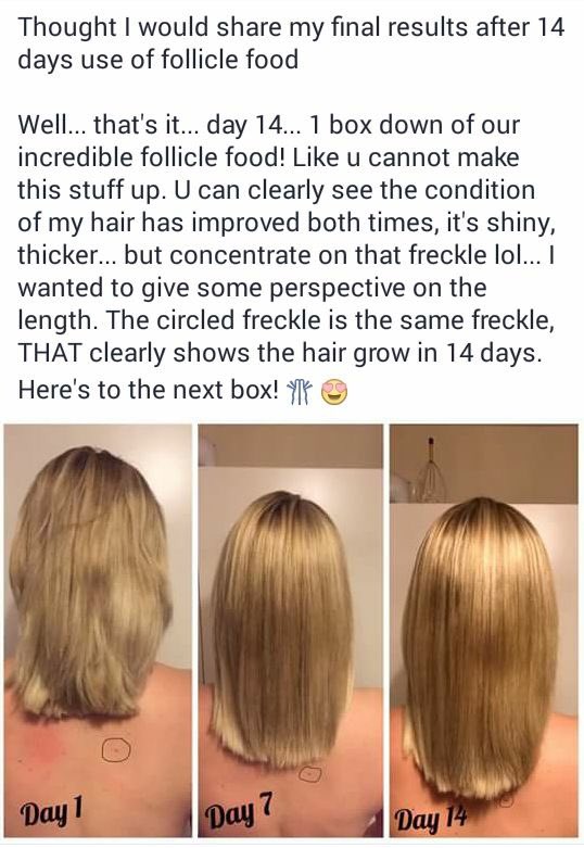Longer hair and fast ! Check out the follicle food dietdetoxtrim.com/collections/ha… #hair #hairloss