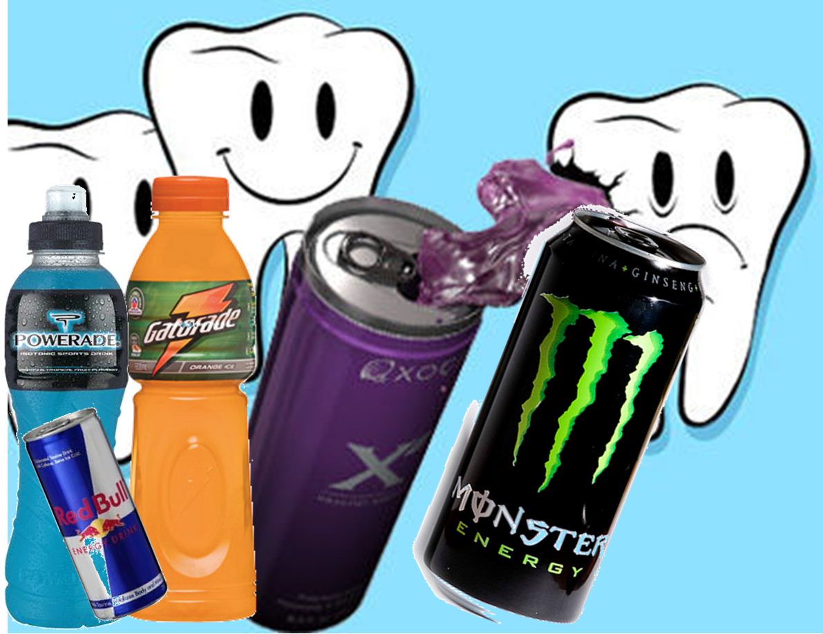 CEIO_Centros's tweet photo. Las bebidas energéticas ¿Pueden perjudicar la salud #dental? https://t.co/9Kk64EsToj https://t.co/ve3hpF3mGO