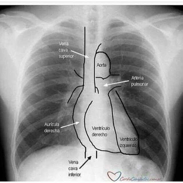 FisioterapiaHo's tweet photo. #physiotherapy  #torax  #fisioterapia   #tórax  #enfermagem   #fisiogata #radiología  #radiologia #corpohumano #uti #raioxdigital https://t.co/BT8UIHtXcr