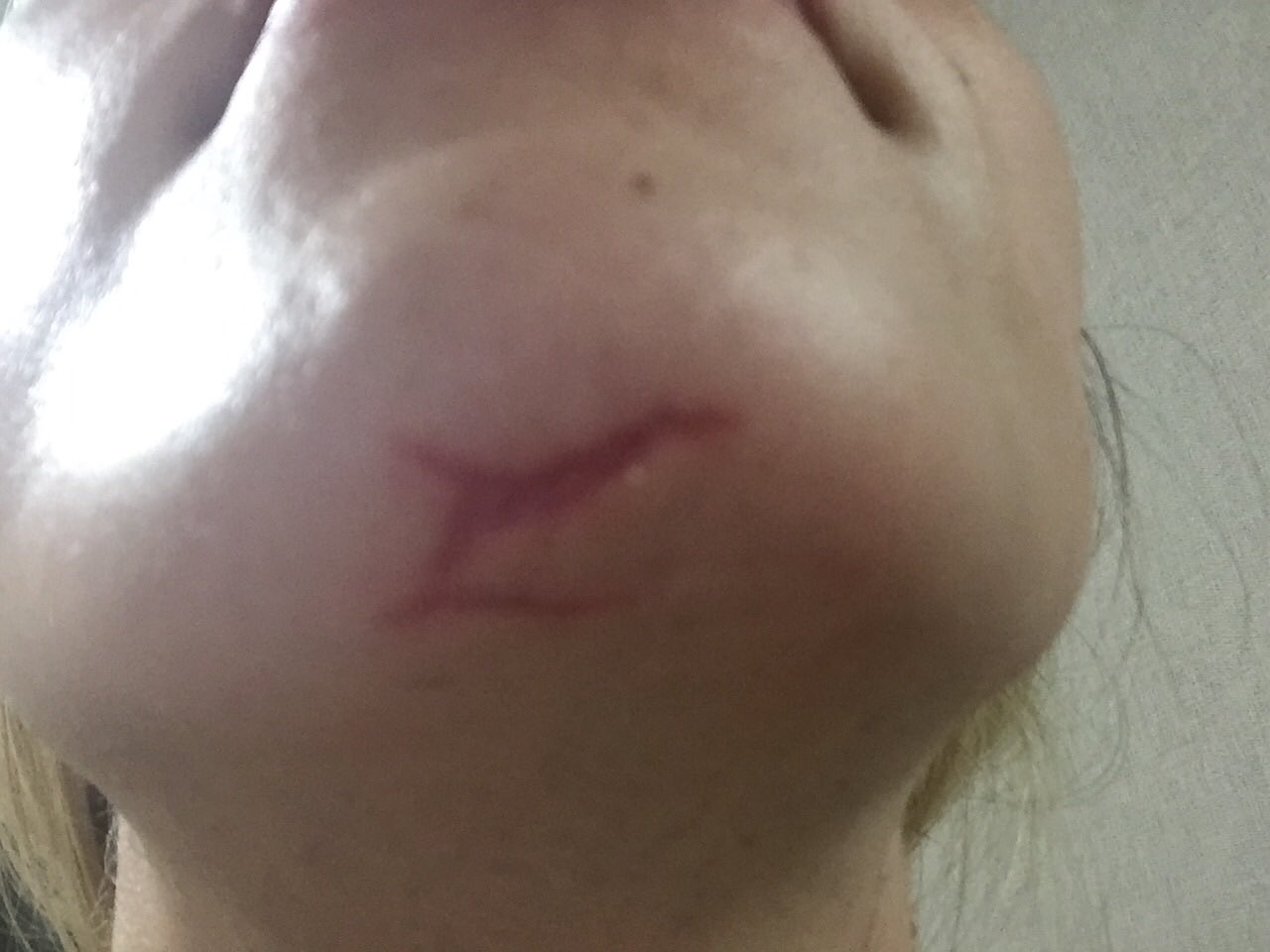 あーたん しかも長くは打てないけれど顎の大怪我も完全に骨昔の顎の大怪我に重なって骨割れて 顎割れて見えるどころか傷も完璧に残るし 携帯文字出るの遅過ぎだし 最悪過ぎる T Co T9hcra1nym Twitter あーたん しかも長くは打てないけれど顎の大怪我も完全に骨昔の顎の大怪我に重なって骨割れて 顎割れて見えるどころか傷も完璧に残るし 携帯文字出るの遅過ぎだし 最悪過ぎる T Co T9hcra1nym Twitter