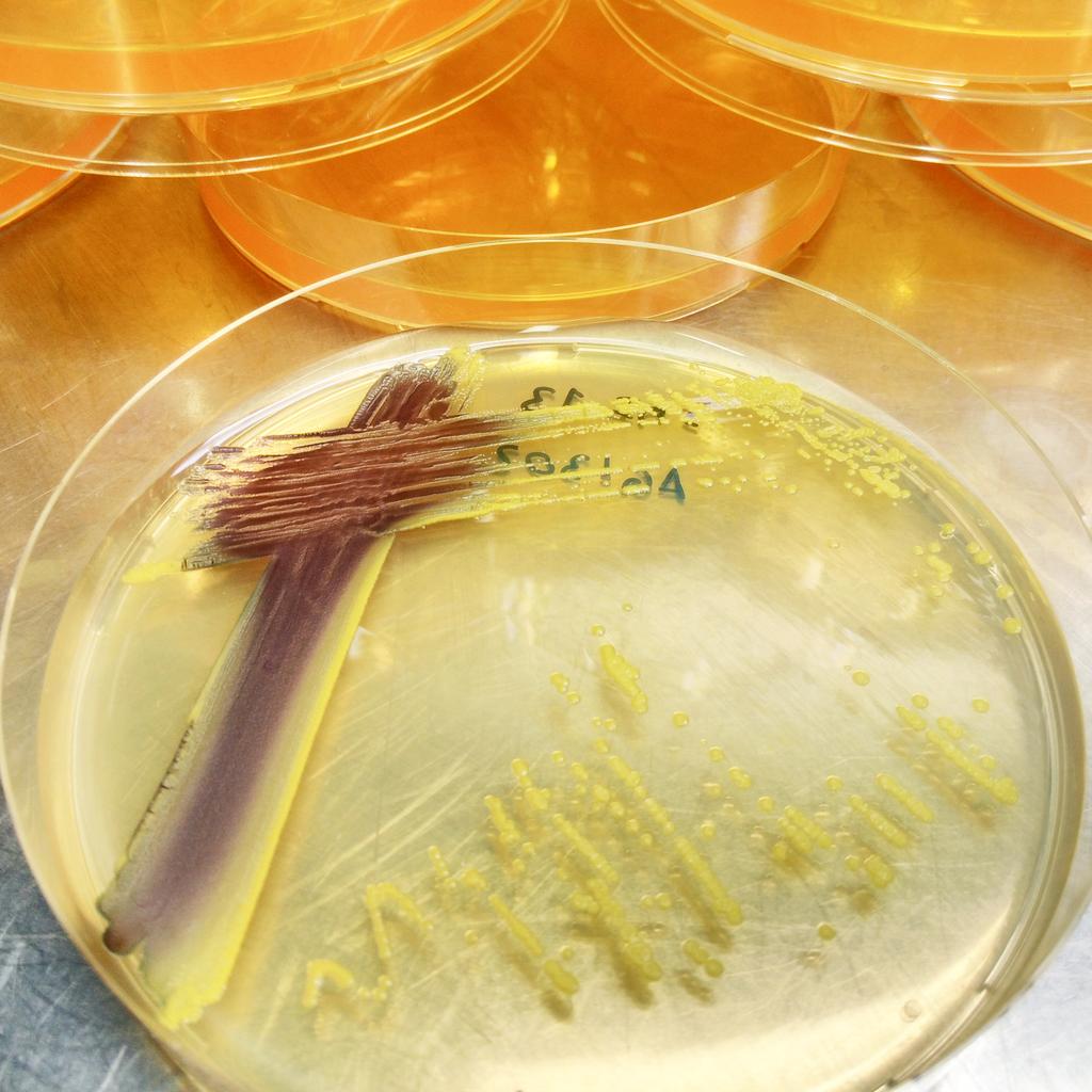 morontafelix's tweet photo. Hi, @BillNye. I'm a microbiologist that uses bacteria for feeding the world. #plantmicrobiome #microbes4crops #BillMeetScienceTwitter https://t.co/C2RaaNRaFA