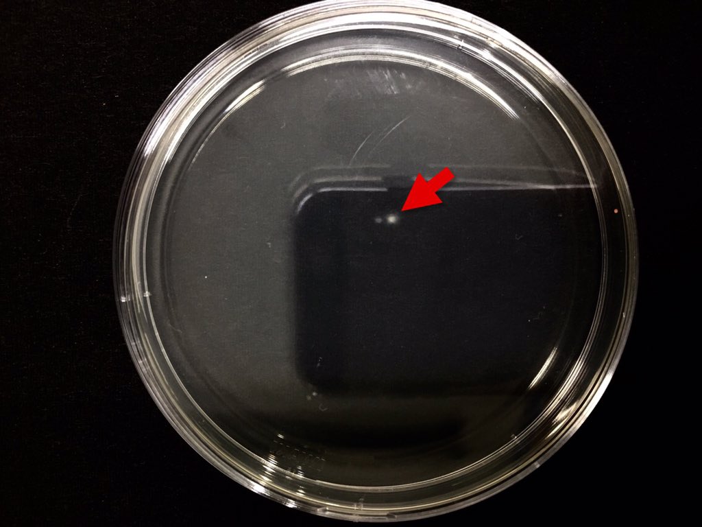 猪口 雅彦 ついでに部屋の清浄度のチェックのために 同じ微生物用培地を5分間ほど室内で蓋を外して放置してみたのですが こちらも カビのコロニーが1個出来ただけでした 案外きれい ゚ ゚ というわけで 植物組織培養はご家庭でも十分可能です 猪口 雅彦 ついでに部屋の清浄度のチェックのために 同じ微生物用培地を5分間ほど室内で蓋を外して放置してみたのですが こちらも カビのコロニーが1個出来ただけでした 案外きれい ゚ ゚ というわけで 植物組織培養はご家庭でも十分可能です