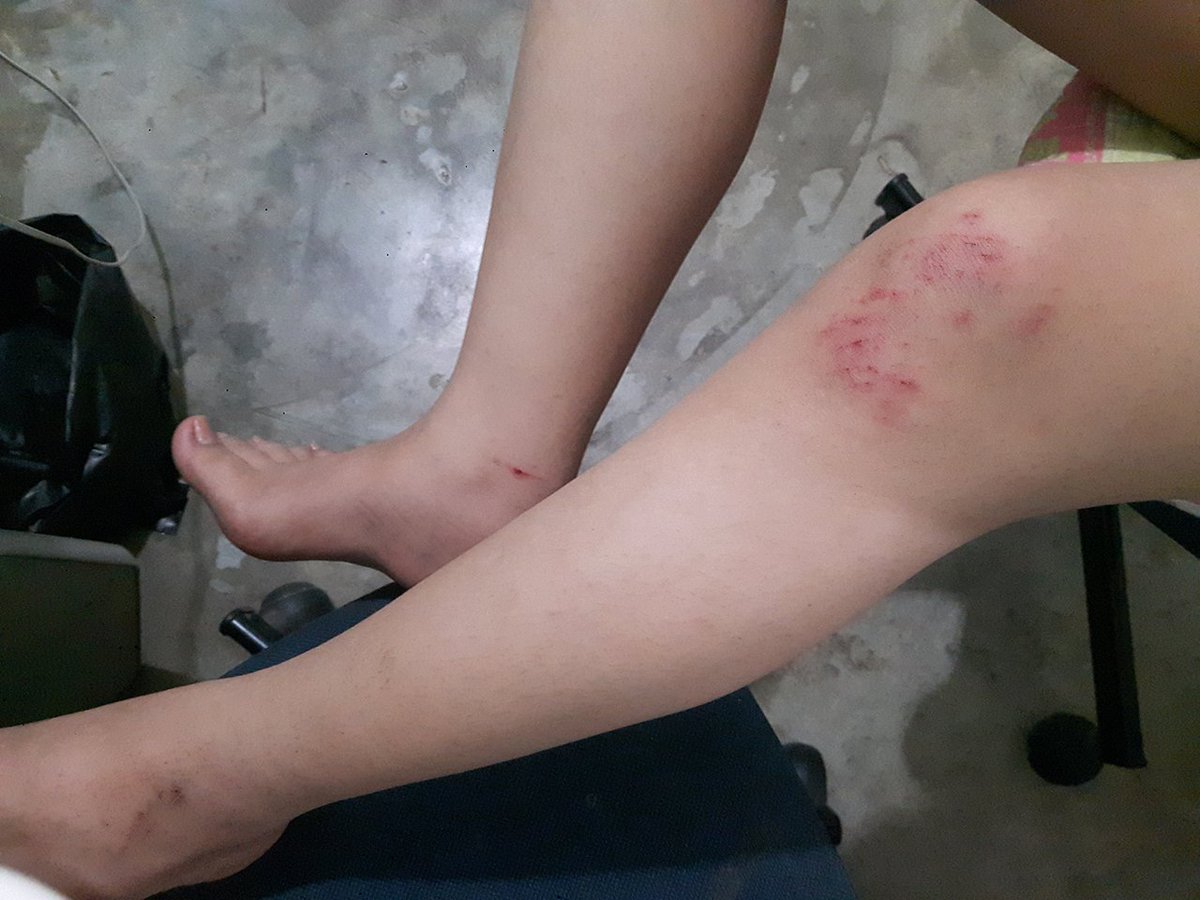 iying03's tweet photo. ���่อคิงเฮาพาลูกหล้ารถล้ม😔ไงเมาไม่ขับบอกแล้ว ลูกก็เมาแต่ขับถึงที่แล้วกันให้ขับแต่แรกก็จบแล้ว😣
ดื่มก็ดื่มเป็นที่เป็นทางกลับไม่ได้ก็ลูกไงคะ. https://t.co/9nlSlqczQp