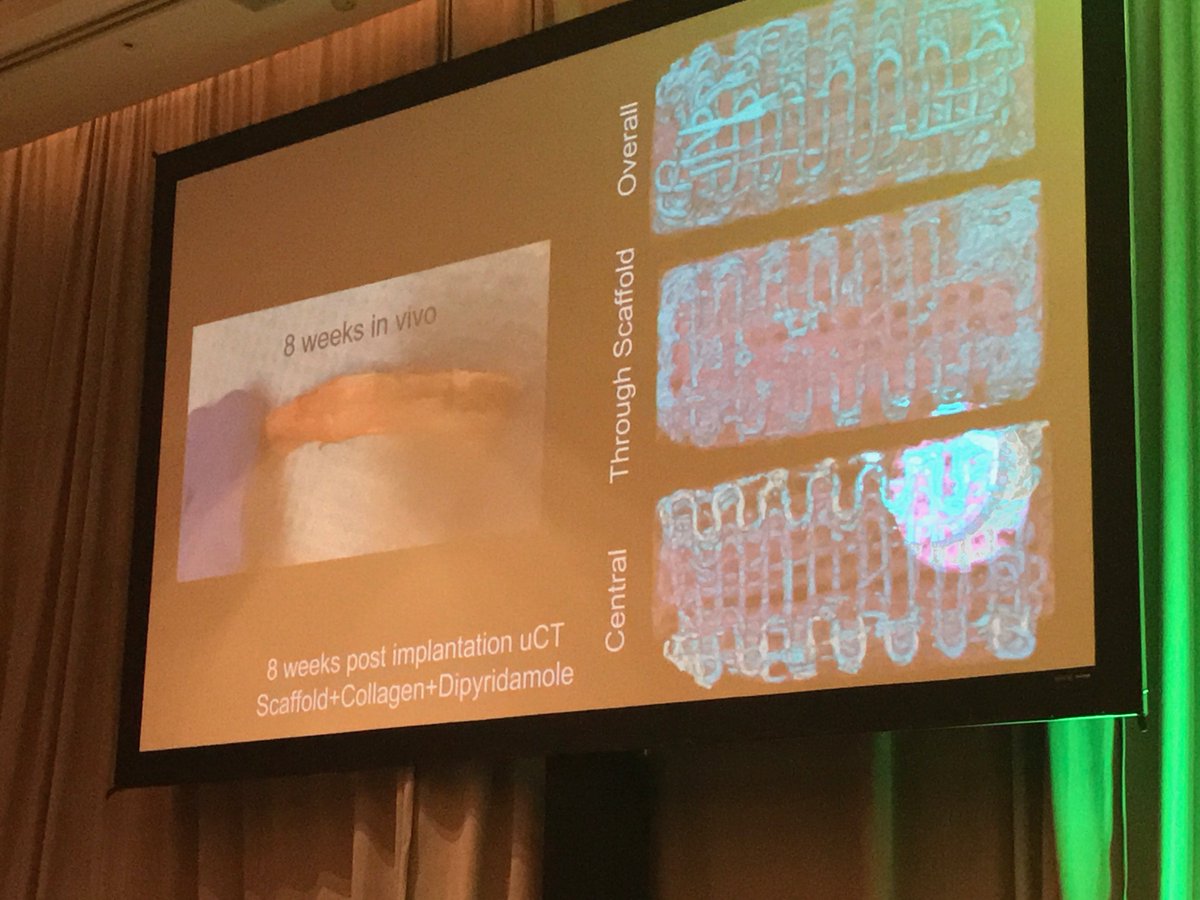 cd_lopez_'s tweet photo. Dr. Coelho: "A2AR agonists proved to extremely valuable for 3D printed scaffold bone regeneration." #tissueengineering #3dprinting https://t.co/wT5Qgu5s2N