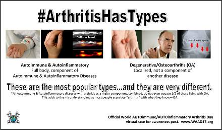 AIArthritisDay's tweet photo. Millions have this type of Arthritis caused by AUTOimmune/AUTOinflammatory diseases #ArthritisHasTypes RT & DRIVE Awareness! #rheum #spoonie https://t.co/noQ1NCv6lk
