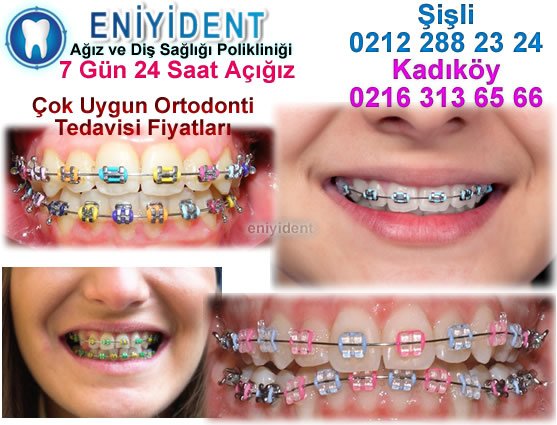 Üsküdar Çocuk Diş Teli Konusunda Bizi ... ve #ÜsküdarDişTeli #ÜsküdarDişTeliFiyatları tüm bilgiler için tıklayınız uzmandisdoktoru.net/uskudar-cocuk-…