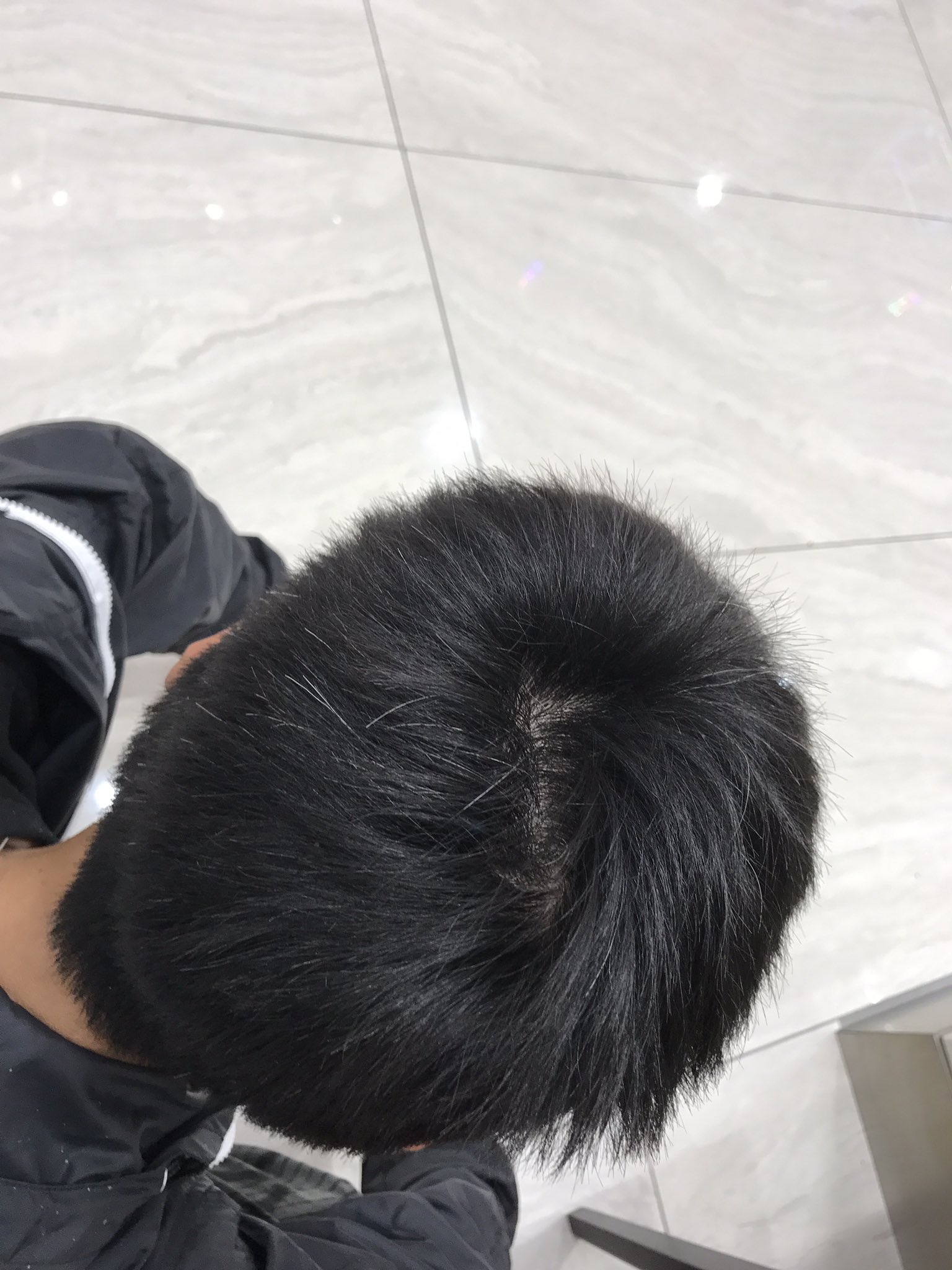 永井浩二 ハゲてるとか言われてるけどハゲてないし 風呂入ってなくてツムジの部分の髪が立っててハゲてるように見えたんじゃね 別にハゲててもいいけどw ツムジでハゲとか笑えるんだがw ボケがディアブロ糞がボケが もおおおおおお