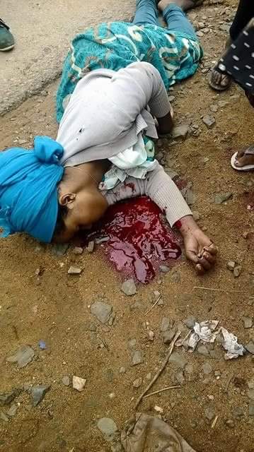 MikaelArage's tweet photo. Tedros has the blood,money&amp;health of millions of Ethiopians in his hand.He ain't worthy 2 lead #WHODG #NoTedros4WHO https://t.co/BeJEOmiopd https://t.co/OwoJBNfOMo