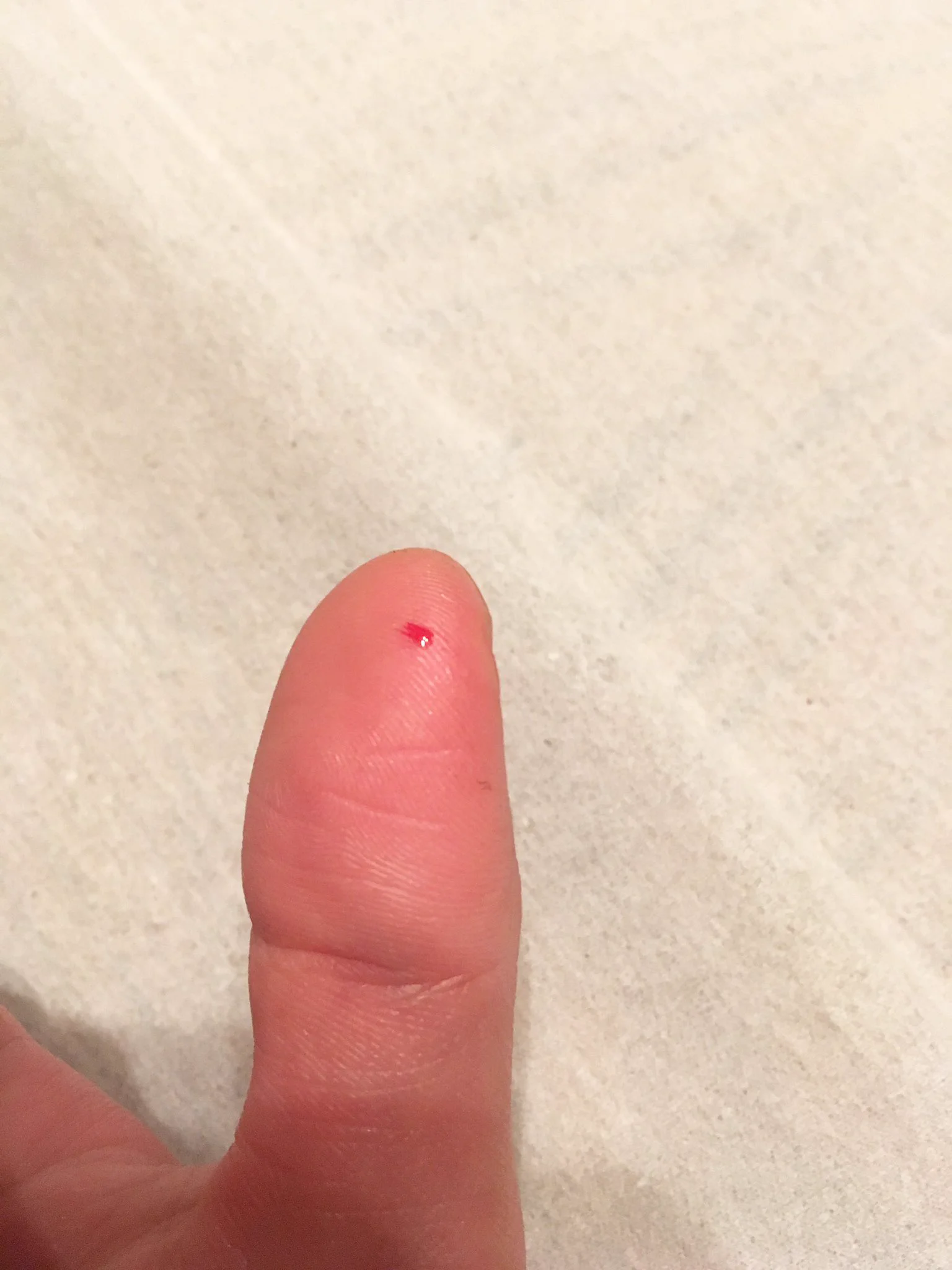 ひよこちゃんマグネットだと思ってボタンをがあったから押した結果ww針が出てきて殺されかけたww