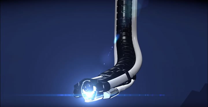 SaluDigital_CS's tweet photo. Una serpiente tecnológica se introduce en el #organismo y mientras se observa la actuación quirúrgica en imágenes 3D https://t.co/SLhJ9PvJbX https://t.co/yD6nAstHrm