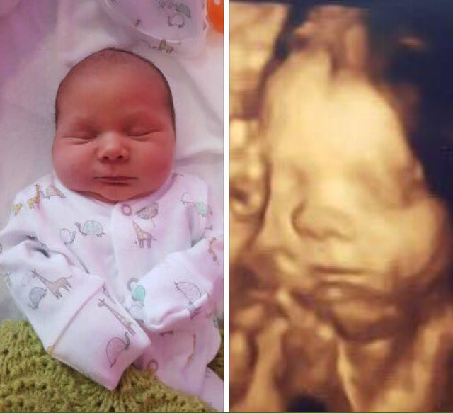 Thank you Holly for sharing these pictures of her gorgeous baby boy Axel who arrived on the 15th weighing 9lbs and 3 weeks early! 💙⭐️🐻